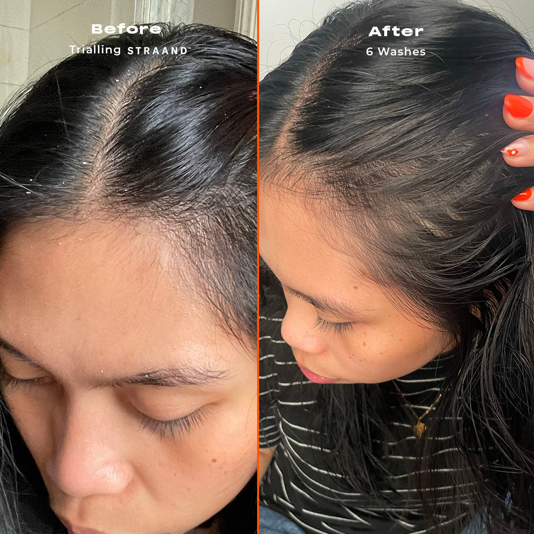 UGLY ANTI-ITCH POWER PACK