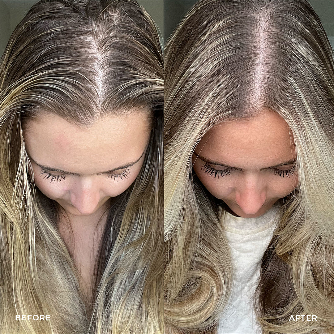 Pre and post-washing using the STRAAND scalp care system
