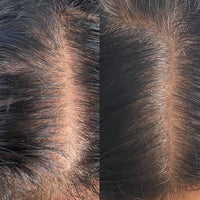 Scalp Essentials & Towel Set