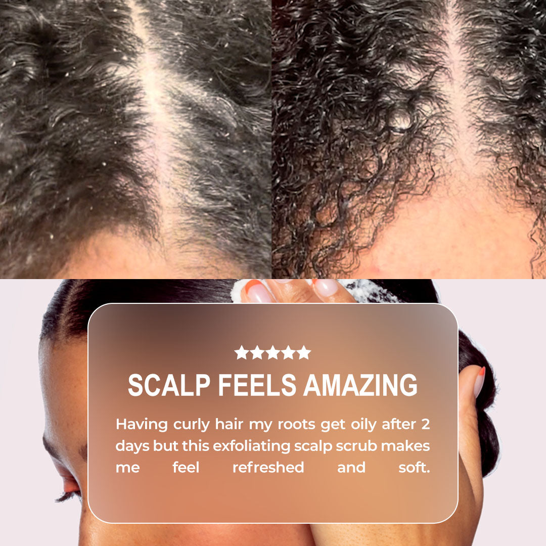 Miracle Worker Exfoliating Scalp Scrub