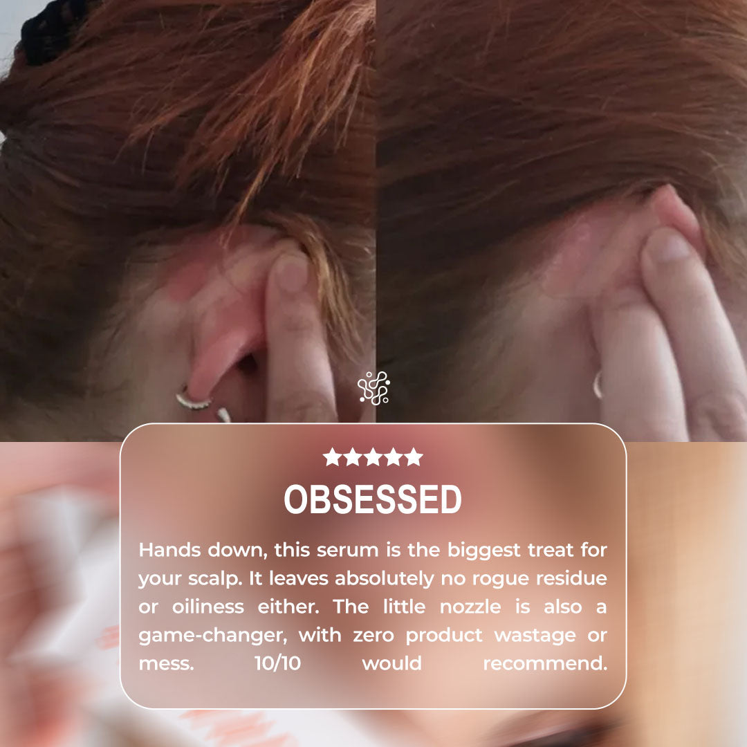 The Crown Fix Scalp Serum