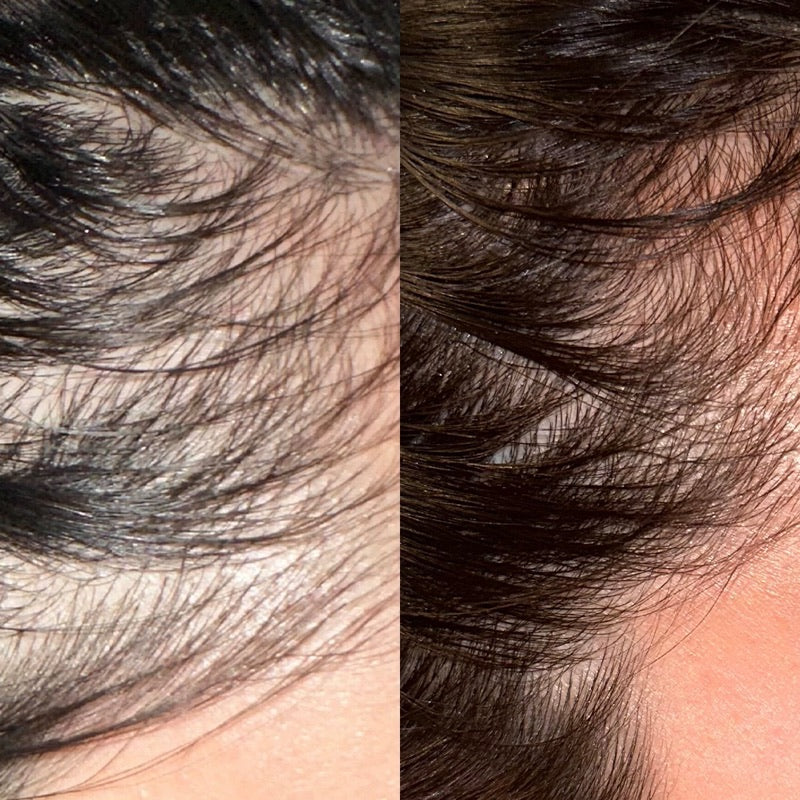 Before and after through the lengths