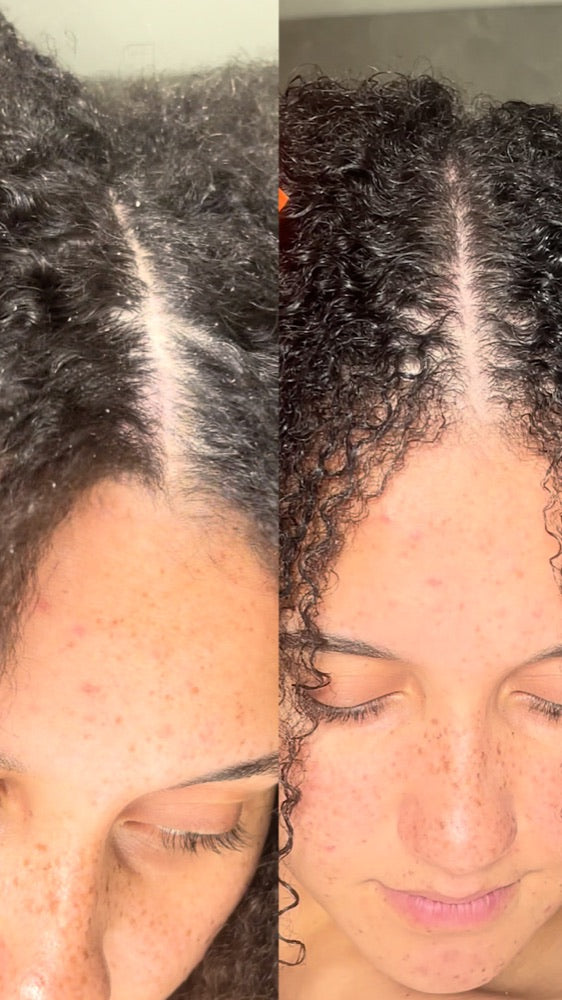 Before and after: visible flakes along the parting, then a clear scalp