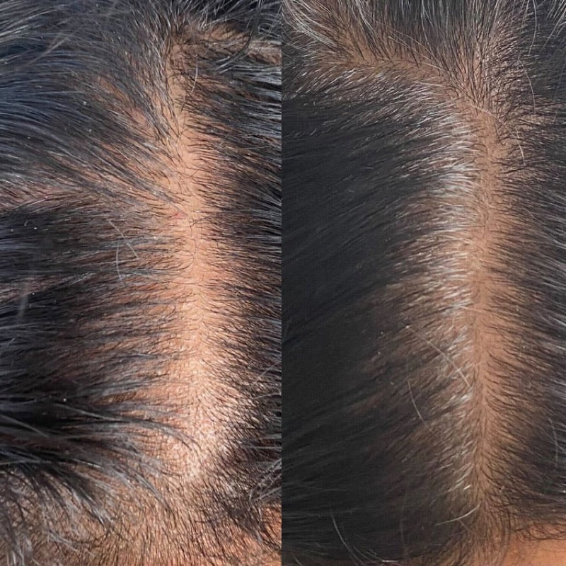 Before and after at the parting
